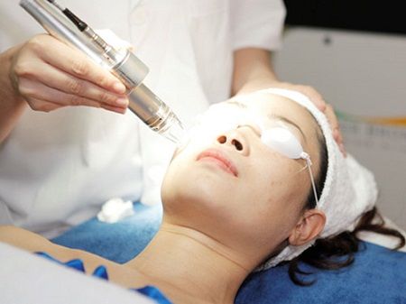 Trị nám bằng laser toning giá bao nhiêu